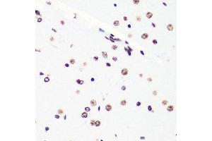 Immunohistochemistry of paraffin-embedded mouse brain using H4K20me2 antibody.