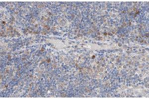 ABIN6266950 at 1/100 staining human lymph node tissue sections by IHC-P. (NCK2 抗体  (Internal Region))