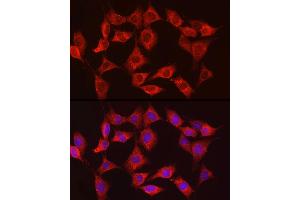 Immunofluorescence analysis of NIH/3T3 cells using HK3 Rabbit pAb (ABIN6131756, ABIN6141801, ABIN6141802 and ABIN6224488) at dilution of 1:150 (40x lens). (HK3 抗体  (AA 1-270))