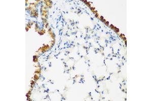 Immunohistochemistry of paraffin-embedded mouse lung using LRP5 antibody (ABIN5974915) at dilution of 1/200 (40x lens).
