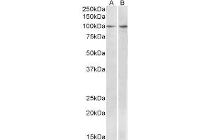 ABIN1590037 (1 µg/mL) staining of MCF7 (A) and Human Breast cancer (B) lysates (35 µg protein in RIPA buffer). (BCAR1 抗体  (Internal Region))