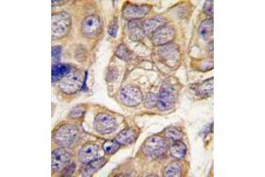 Image no. 2 for anti-Cadherin 13 (CDH13) (C-Term) antibody (ABIN356921) (Cadherin 13 抗体  (C-Term))