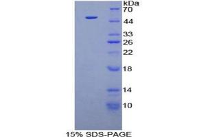 SDS-PAGE analysis of Human FGF6 Protein. (FGF6 蛋白)