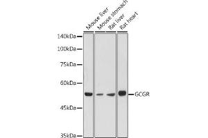 Western blot analysis of extracts of various cell lines, using GCGR antibody (ABIN7267394) at 1:1000 dilution. (Glucagon Receptor 抗体  (AA 1-140))