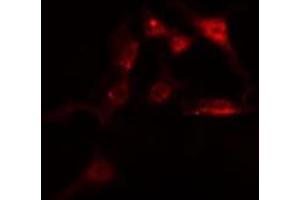 ABIN6275142 staining  HeLa cells by IF/ICC. (IFI16 抗体  (C-Term))