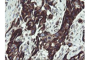 Image no. 1 for anti-Tumor Protein D52-Like 3 (TPD52L3) antibody (ABIN1501475) (TPD52L3 抗体)