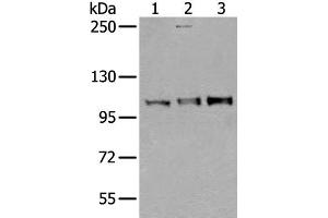 Western blot analysis of Mouse testis tissue Jurkat and A549 cell lysates using USO1 Polyclonal Antibody at dilution of 1:350 (USO1 抗体)