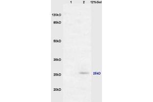 Lane 1: mouse embryo lysates Lane 2: mouse brain lysates probed with Anti RASSF3 Polyclonal Antibody, Unconjugated (ABIN762101) at 1:200 in 4 °C. (RASSF3 抗体  (AA 51-150))