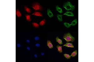 ABIN6259043 and ABIN6274716 staining Hela cells by IF/ICC.