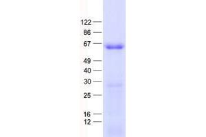 Western Blotting (WB) image for Zinc Finger Protein 597 (ZNF597) protein (His tag) (ABIN2736081)