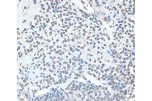 Immunohistochemistry (Paraffin-embedded Sections) (IHC (p)) image for anti-Zinc Finger Protein 433 (ZNF433) antibody (ABIN7258240)