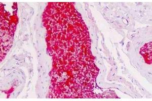 Immunohistochemistry (IHC) image for anti-serpin Peptidase Inhibitor, Clade A (Alpha-1 Antiproteinase, Antitrypsin), Member 1 (SERPINA1) antibody (ABIN1804336)