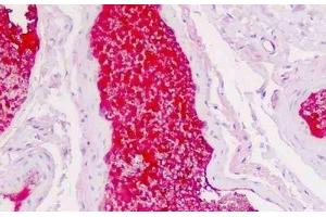 Human Colon, Vessel Plasma: Formalin-Fixed, Paraffin-Embedded (FFPE) (SERPINA1 抗体)