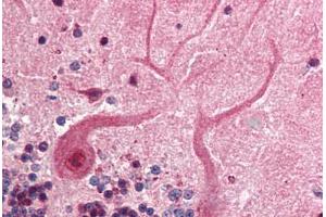 Human Brain, Cerebellum (formalin-fixed, paraffin-embedded) stained with SKP1 antibody ABIN218526 at 1:500 followed by biotinylated goat anti-rabbit IgG secondary antibody ABIN481713, alkaline phosphatase-streptavidin and chromogen. (SKP1 抗体  (C-Term))