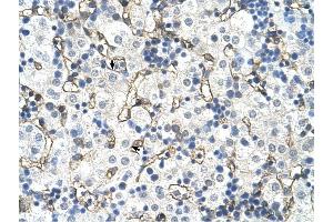 SLC39A5 antibody was used for immunohistochemistry at a concentration of 4-8 ug/ml to stain Hepatocytes (arrows) in Human Liver. (SLC39A5 抗体)