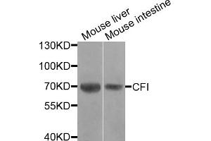 Western blot analysis of extracts of various cell lines, using CFI antibody. (Complement Factor I 抗体)
