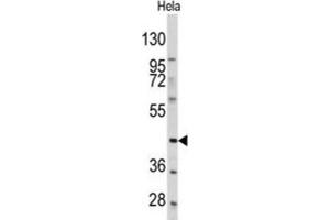 Western Blotting (WB) image for anti-Platelet-Derived Growth Factor Receptor-Like (PDGFRL) antibody (ABIN3003406) (PDGFRL 抗体)