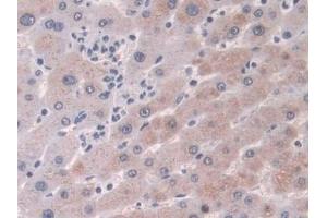 Detection of CRABP2 in Human Liver Tissue using Polyclonal Antibody to Cellular Retinoic Acid Binding Protein 2 (CRABP2) (CRABP2 抗体  (AA 1-138))