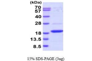 SDS-PAGE (SDS) image for Dual Specificity Phosphatase 23 (DUSP23) (AA 1-150) (Active) protein (His tag) (ABIN6388007) (DUSP23 Protein (AA 1-150) (His tag))