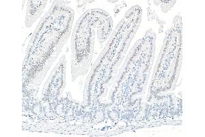 Immunohistochemistry (IHC) image for anti-AT Rich Interactive Domain 1B (SWI1-Like) (ARID1B) (AA 1425-1475) antibody (ABIN7795694) (Recombinant ARID1B 抗体  (AA 1425-1475))