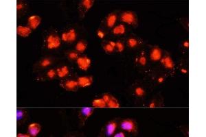 Immunofluorescence analysis of HeLa cells using HOXB9 Polyclonal Antibody at dilution of 1:100 (40x lens). (HOXB9 抗体)