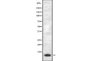 Western blot analysis of VAMP-1/2/3 using Jurkat whole cell lysates (Vamp-1+2+3 抗体)