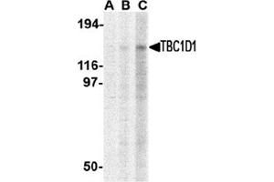 Western blot analysis of TBC1D1 in Daudi cell lysate with this product at (A) 1, (B) 2 and (C) 4 μg/ml. (TBC1D1 抗体  (C-Term))