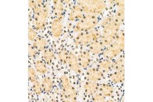 Immunohistochemistry of paraffin embedded rat kidney using HOXC9 (ABIN7074251) at dilution of 1:700 (400x lens)