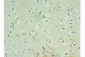 Immunohistochemistry of paraffin-embedded human brain tissue using ABIN7148809 at dilution of 1:100 (ATF7 抗体  (AA 1-117))