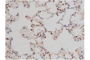 ABIN6267437 at 1/200 staining Rat lung tissue sections by IHC-P. (RPS6KB1 抗体  (pThr229))