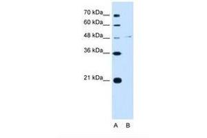Image no. 1 for anti-Olfactomedin 4 (OLFM4) (C-Term) antibody (ABIN321838) (Olfactomedin 4 抗体  (C-Term))