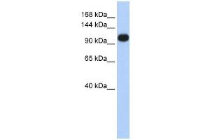 ATP2A3 antibody used at 1 ug/ml to detect target protein. (ATP2A3 抗体  (Middle Region))