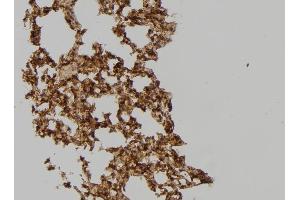 ABIN6259350 and ABIN6275567 at 1/100 staining Mouse lung tissue by IHC-P.