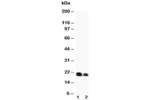 Western blot testing of IL-6 antibody and recombinant protein (1) 10ng, (2) 5ng