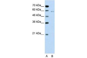 WB Suggested Anti-CDC23  Antibody Titration: 0. (CDC23 抗体  (C-Term))
