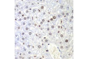 Immunohistochemistry of paraffin-embedded mouse liver using UHRF2 antibody at dilution of 1:200 (400x lens). (UHRF2 抗体)