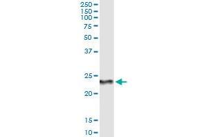 Immunoprecipitation of RCVRN transfected lysate using anti-RCVRN monoclonal antibody and Protein A Magnetic Bead , and immunoblotted with RCVRN MaxPab rabbit polyclonal antibody. (Recoverin 抗体  (AA 91-181))