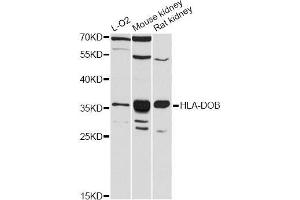 Western blot analysis of extracts of various cell lines, using HLA-DOB antibody (ABIN5997900) at 1:3000 dilution. (HLA-DOB 抗体)