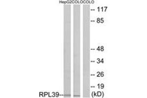 Western blot analysis of extracts from COLO/HepG2 cells, using RPL39 Antibody. (RPL39 抗体  (AA 1-50))