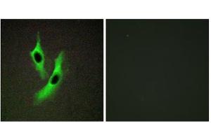 Immunofluorescence analysis of Jurkat cells, using STEAP4 antibody. (STEAP4 抗体  (Internal Region))