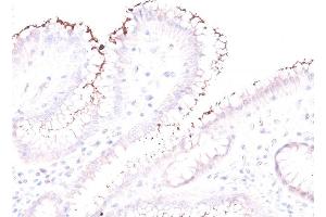 Formalin-fixed, paraffin-embedded human Stomach stained with Helicobacter pylori Rabbit PAb. (Helicobacter Pylori 抗体)