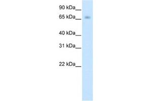 Western Blotting (WB) image for anti-Kelch-like protein 41 (KLHL41) antibody (ABIN2461774) (Kelch-like protein 41 (KLHL41) 抗体)