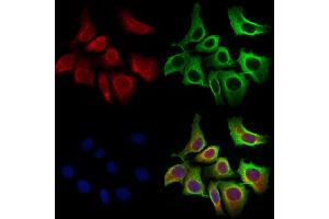 ABIN6259716 and ABIN6273088 staining Hela cells by IF/ICC.