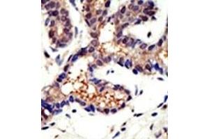 Image no. 1 for anti-Ubiquilin 3 (UBQLN3) (N-Term) antibody (ABIN357613) (Ubiquilin 3 抗体  (N-Term))