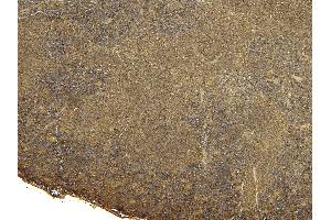 Immunohistochemistry (IHC) image for anti-Forkhead Box P3 (FOXP3) (C-Term) antibody (ABIN185239)