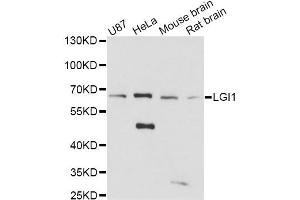 Western blot analysis of extracts of various cell lines, using LGI1 antibody (ABIN1876596) at 1:3000 dilution. (LGI1 抗体)