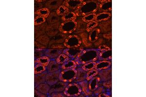 Immunofluorescence analysis of human kidney using V1B1 Rabbit pAb (ABIN6131094, ABIN6137346, ABIN6137347 and ABIN6222603) at dilution of 1:200 (40x lens). (ATP6V1B1 抗体  (AA 1-280))