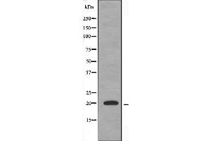 Western blot analysis of extracts from HuvEc cells, using TNFAIP8L2 antibody. (TNFAIP8L2 抗体  (Internal Region))