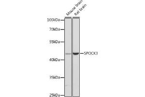 Western blot analysis of extracts of various cell lines, using SPOCK3 antibody (ABIN6131057, ABIN6148367, ABIN6148368 and ABIN6216626) at 1:3000 dilution. (SPOCK3 抗体  (AA 180-380))