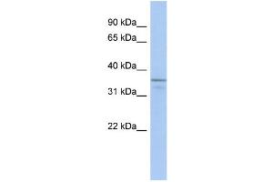 WB Suggested Anti-UBLCP1 Antibody Titration: 0. (UBLCP1 抗体  (N-Term))